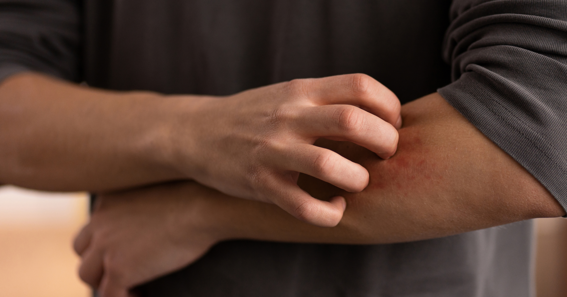 IMG-Itch-Scratch Cycle